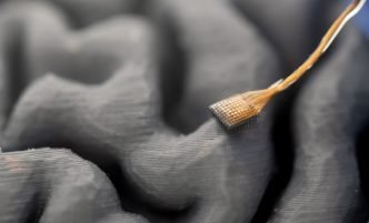 New Brain Implant Technology Restores Instant Speech