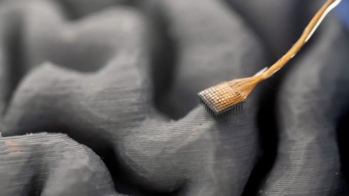 New Brain Implant Technology Restores Instant Speech