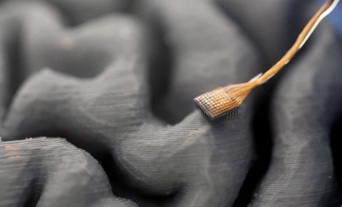 New Brain Implant Technology Restores Instant Speech