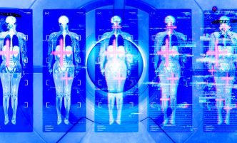 Are Full-Body MRIs Worth the Stress?