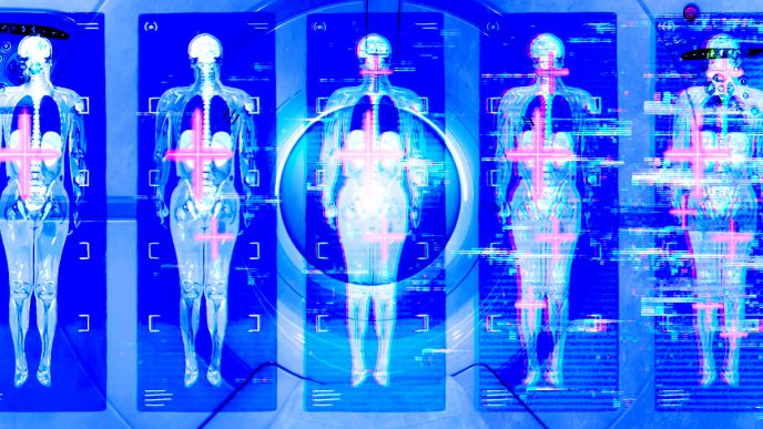 Are Full-Body MRIs Worth the Stress?