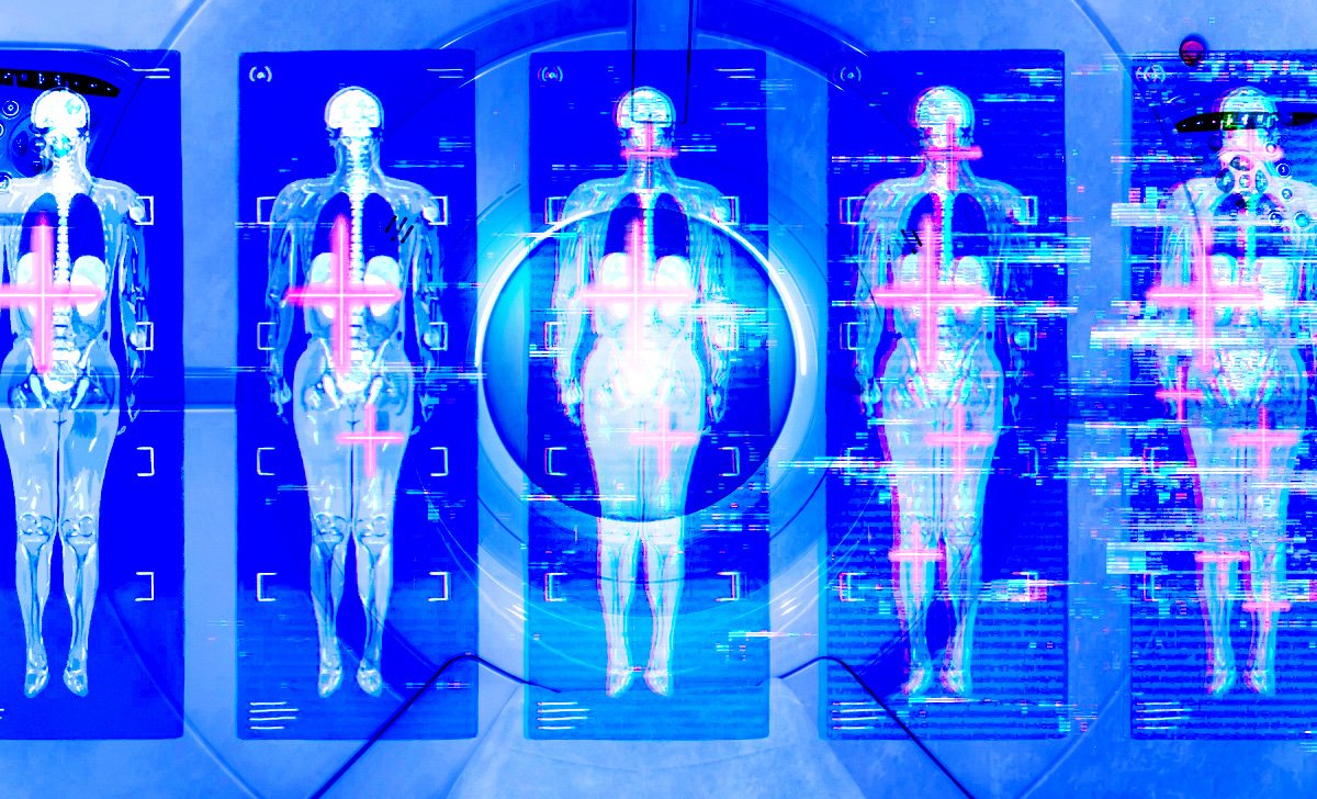 Are Full-Body MRIs Worth the Stress?